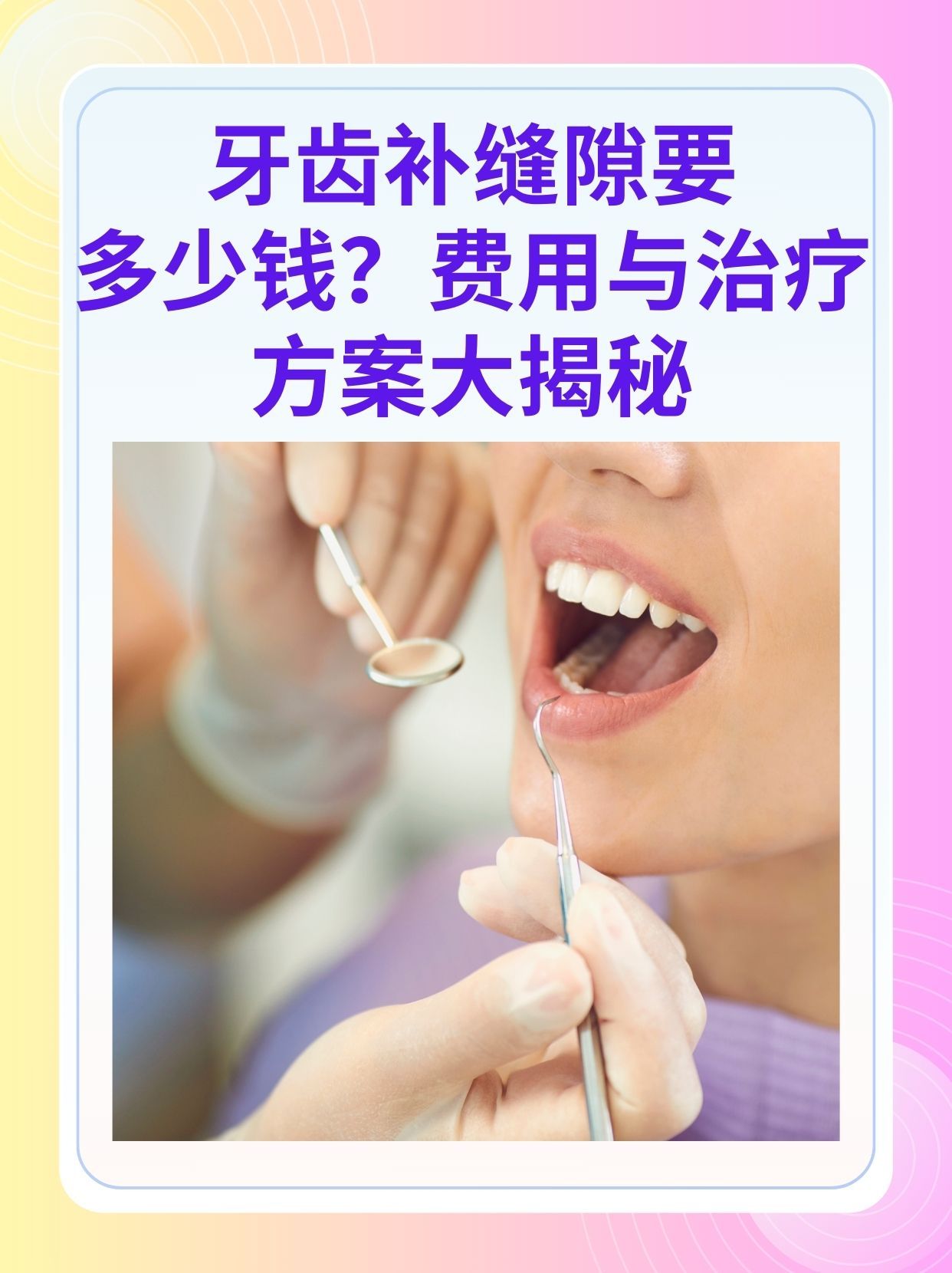 湘潭补牙医保可以报销吗(补牙医保可以报销吗 哪些可以报销呢)